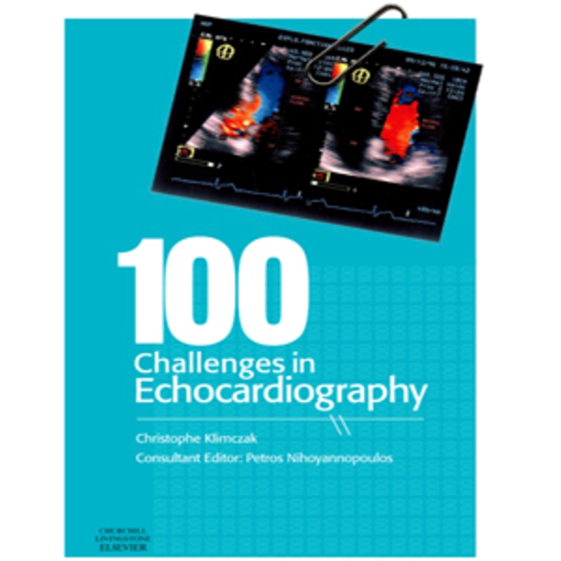 100 Challenges in Echocardiography